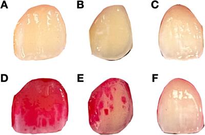 Automated machine learning for image-based detection of dental plaque on permanent teeth